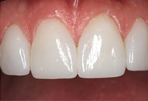 Smile Care Dental Group | Teeth Whitening, Sports Mouthguards and Dental Fillings