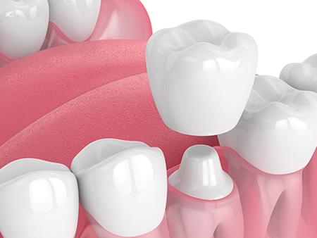 Smile Care Dental Group